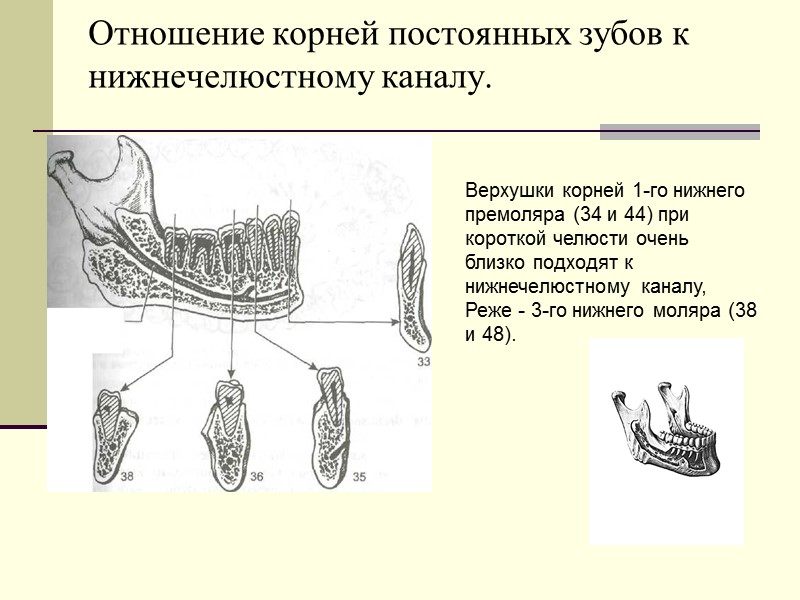 Отношение корней постоянных зубов к нижнечелюстному каналу.  Верхушки корней 1-го нижнего премоляра (34